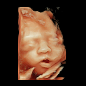 Prevención en el embarazo